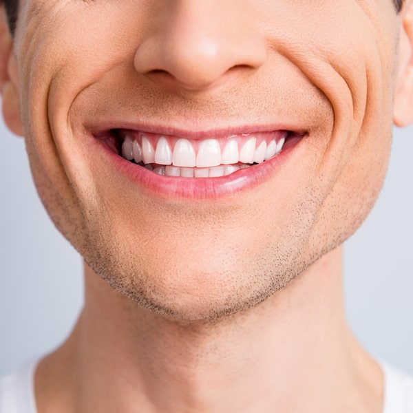 Close-up image of a man's smile.
