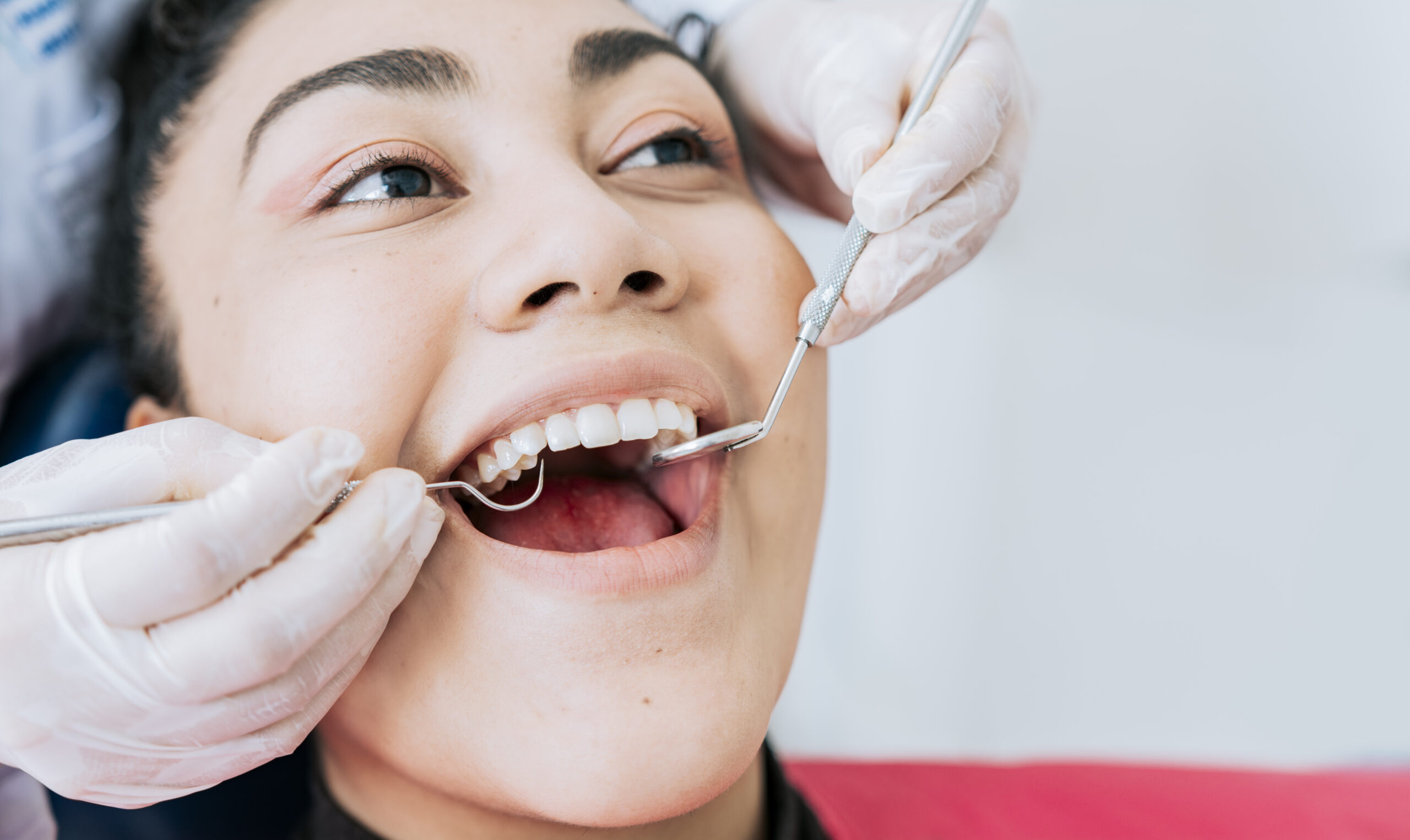 Young woman with her mouth open wide getting a teeth cleaning from a professional whose gloved hands holding dental probes are on either side of the patient's mouth